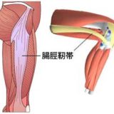 長引く腸脛靭帯炎、練習を継続しながら治療するために私がやったこと。